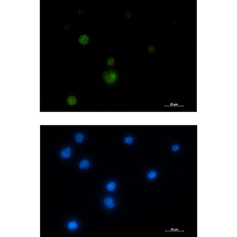 Anti-E1B AP5 Rabbit Monoclonal Antibody