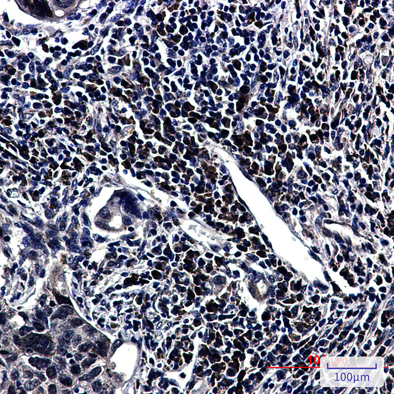 Anti-E1B AP5 Rabbit Monoclonal Antibody