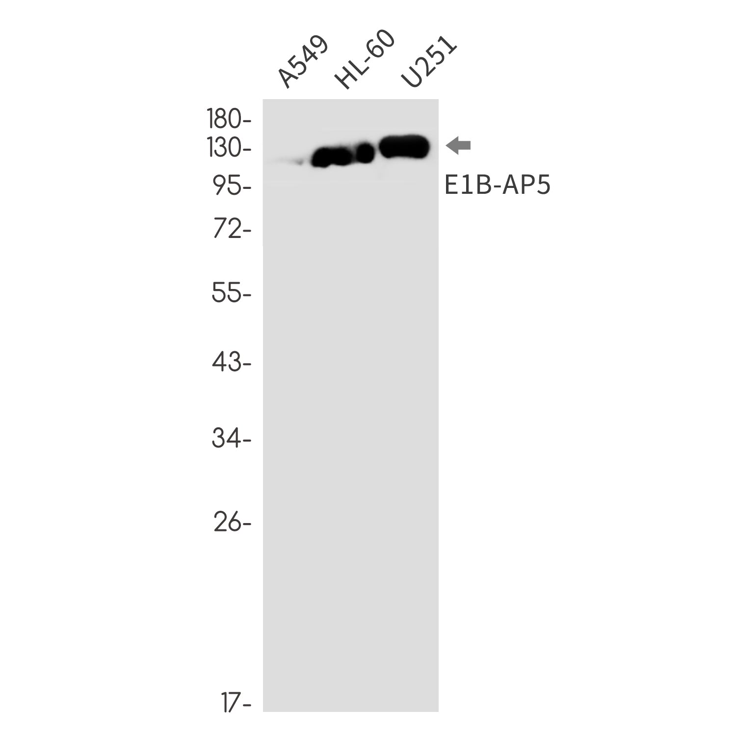Anti-E1B AP5 Rabbit Monoclonal Antibody