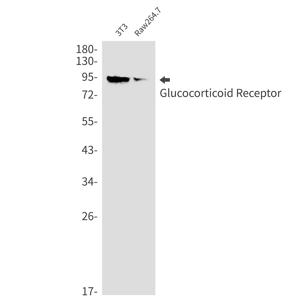 Anti-Glucocorticoid Receptor Rabbit Monoclonal Antibody