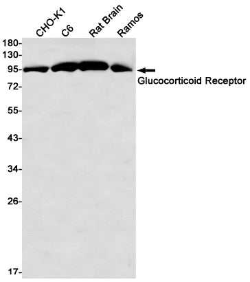 Anti-Glucocorticoid Receptor Rabbit Monoclonal Antibody