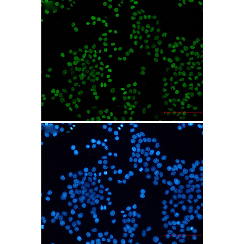 Anti-Acetyl-Histone H3 (Lys27) Rabbit Monoclonal Antibody