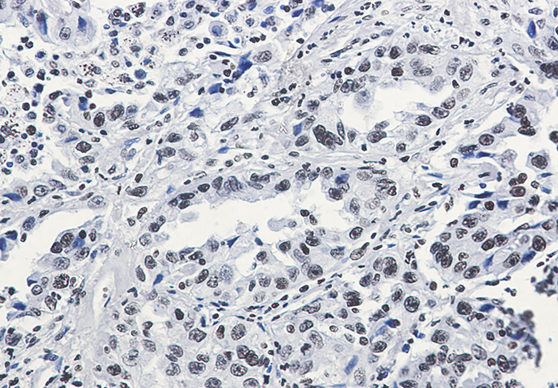 Anti-Acetyl-Histone H3 (Lys27) Rabbit Monoclonal Antibody