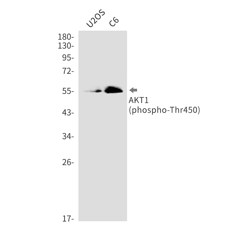 Anti-Phospho-AKT1 (Thr450) Rabbit Monoclonal Antibody