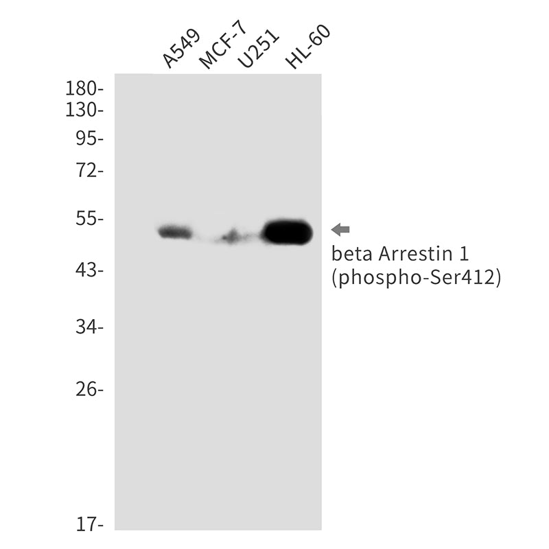 Anti-Phospho-beta Arrestin 1 (Ser412) Rabbit Monoclonal Antibody