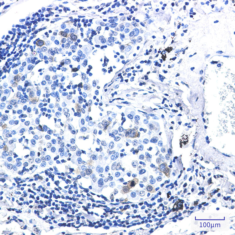 Anti-Phospho-CDK1/2 (Thr14) Rabbit Monoclonal Antibody