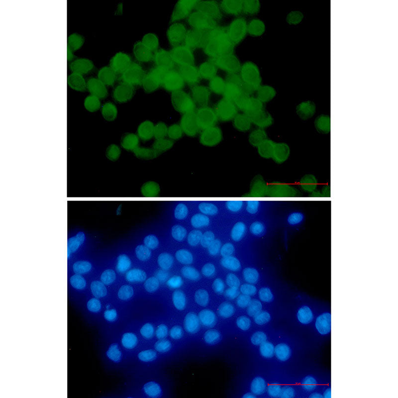Anti-Phospho-delta 1 Catenin (Thr916) Rabbit Monoclonal Antibody