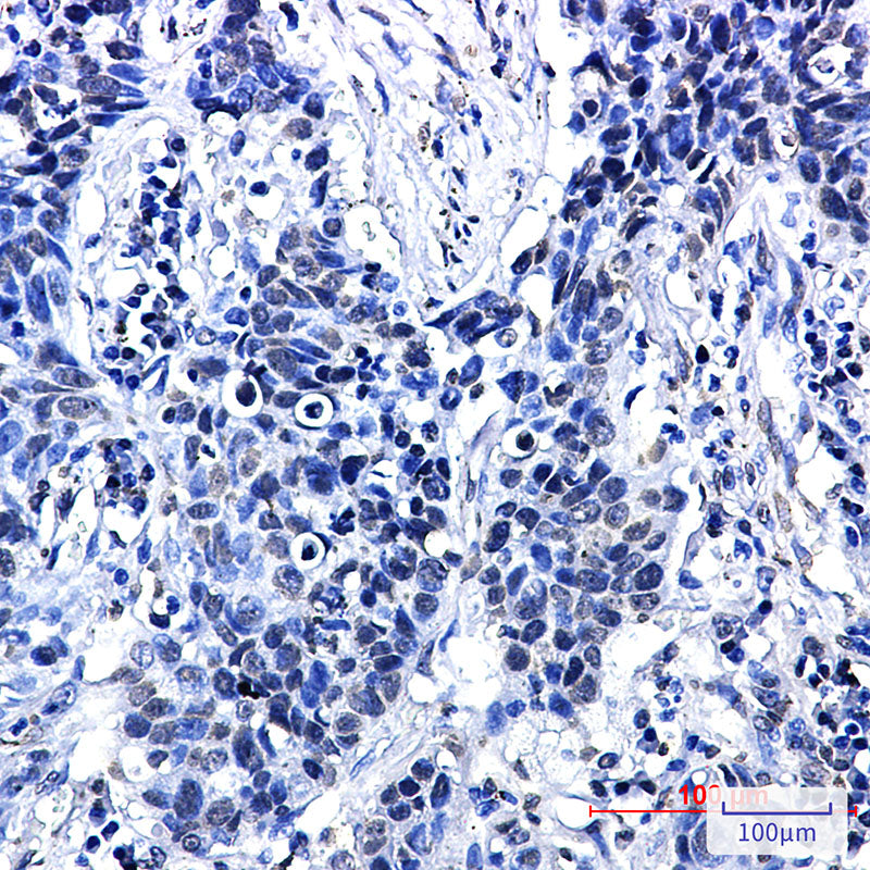 Anti-Phospho-delta 1 Catenin (Thr916) Rabbit Monoclonal Antibody