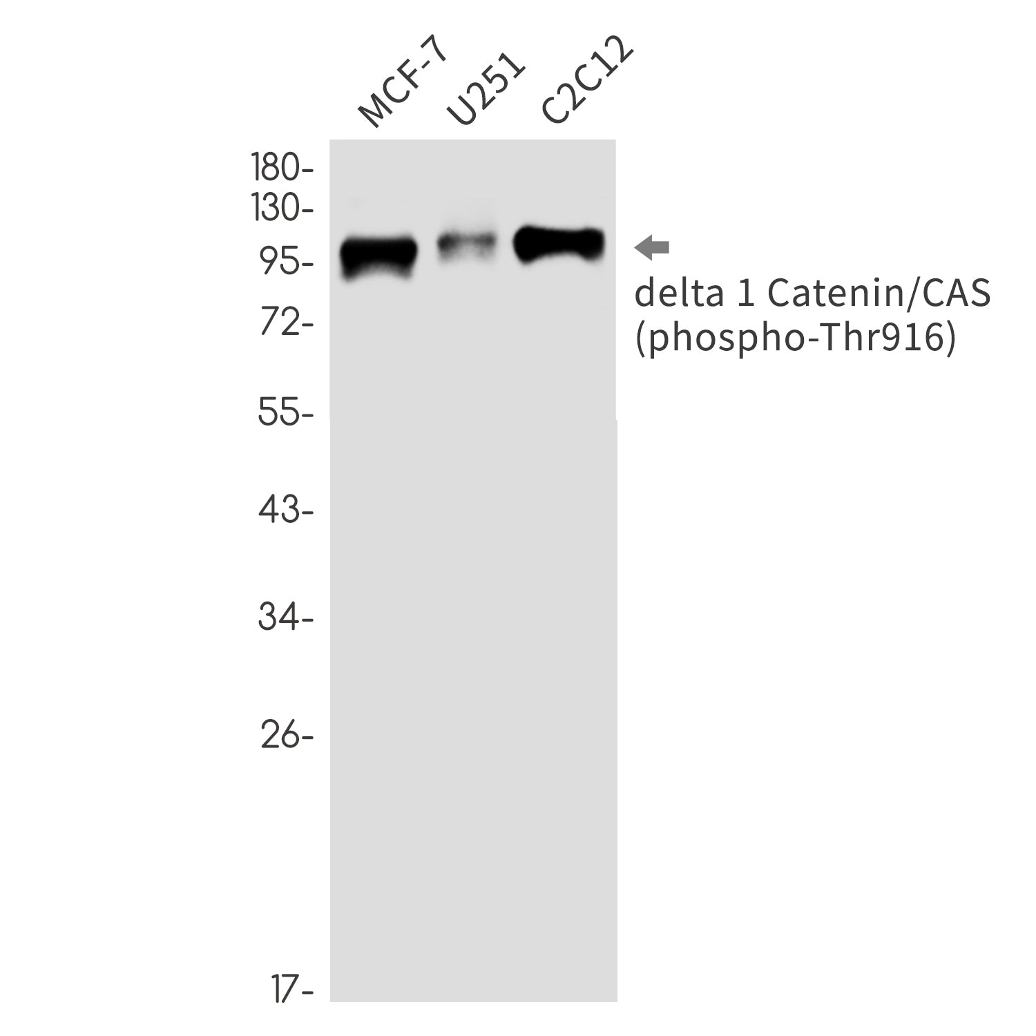 Anti-Phospho-delta 1 Catenin (Thr916) Rabbit Monoclonal Antibody