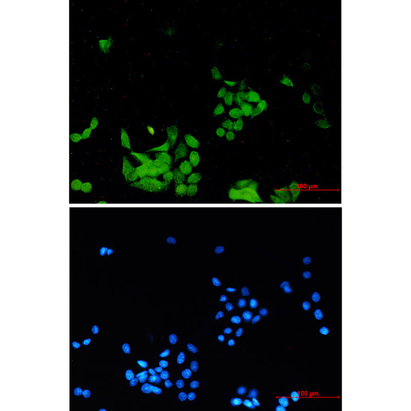 Anti-Phospho-EGFR (Tyr1173) Rabbit Monoclonal Antibody