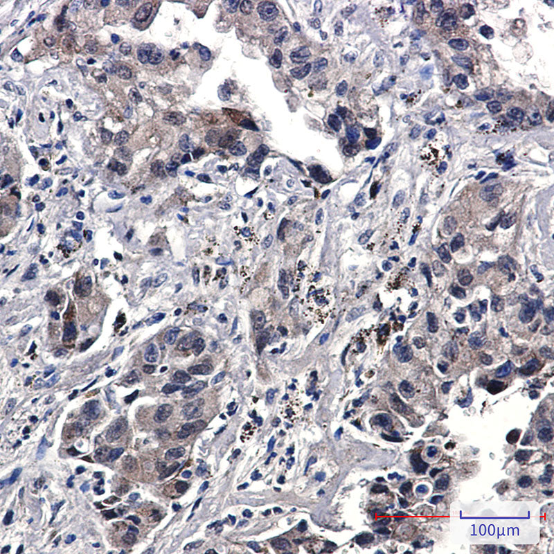 Anti-Phospho-EGFR (Tyr1173) Rabbit Monoclonal Antibody