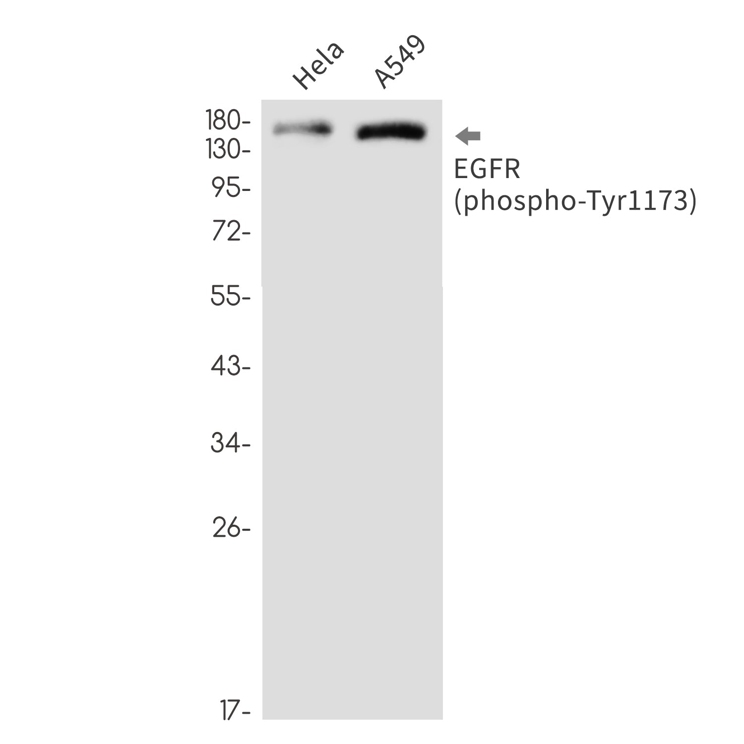 Anti-Phospho-EGFR (Tyr1173) Rabbit Monoclonal Antibody