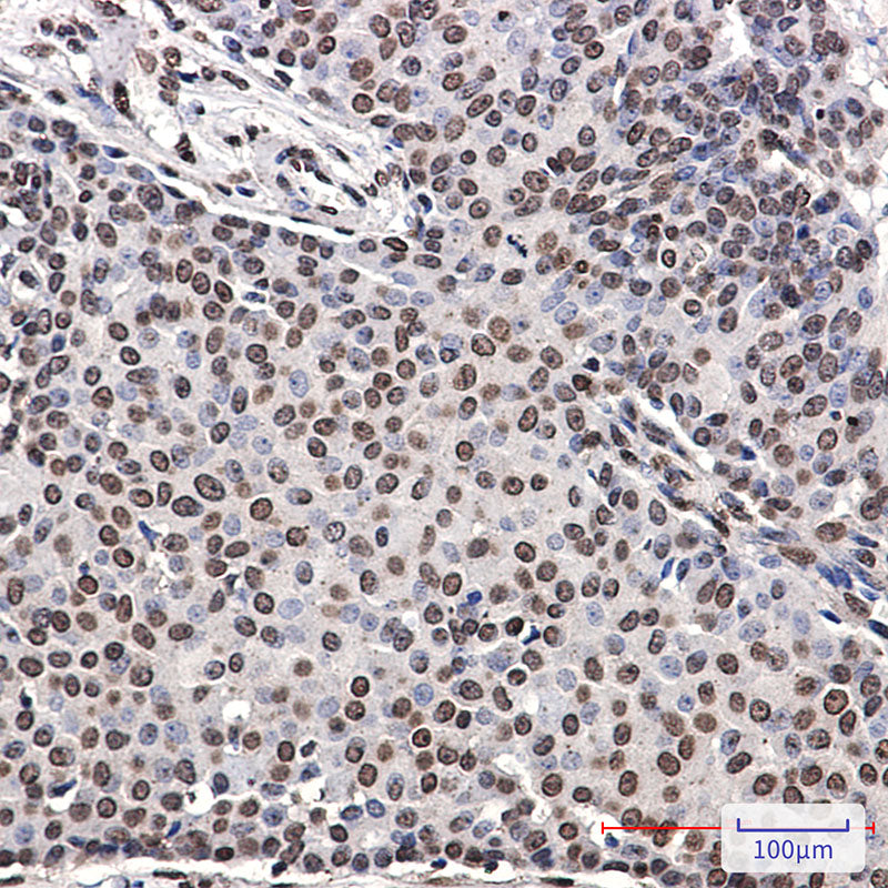 Anti-Phospho-ErbB 4 (Tyr1162) Rabbit Monoclonal Antibody