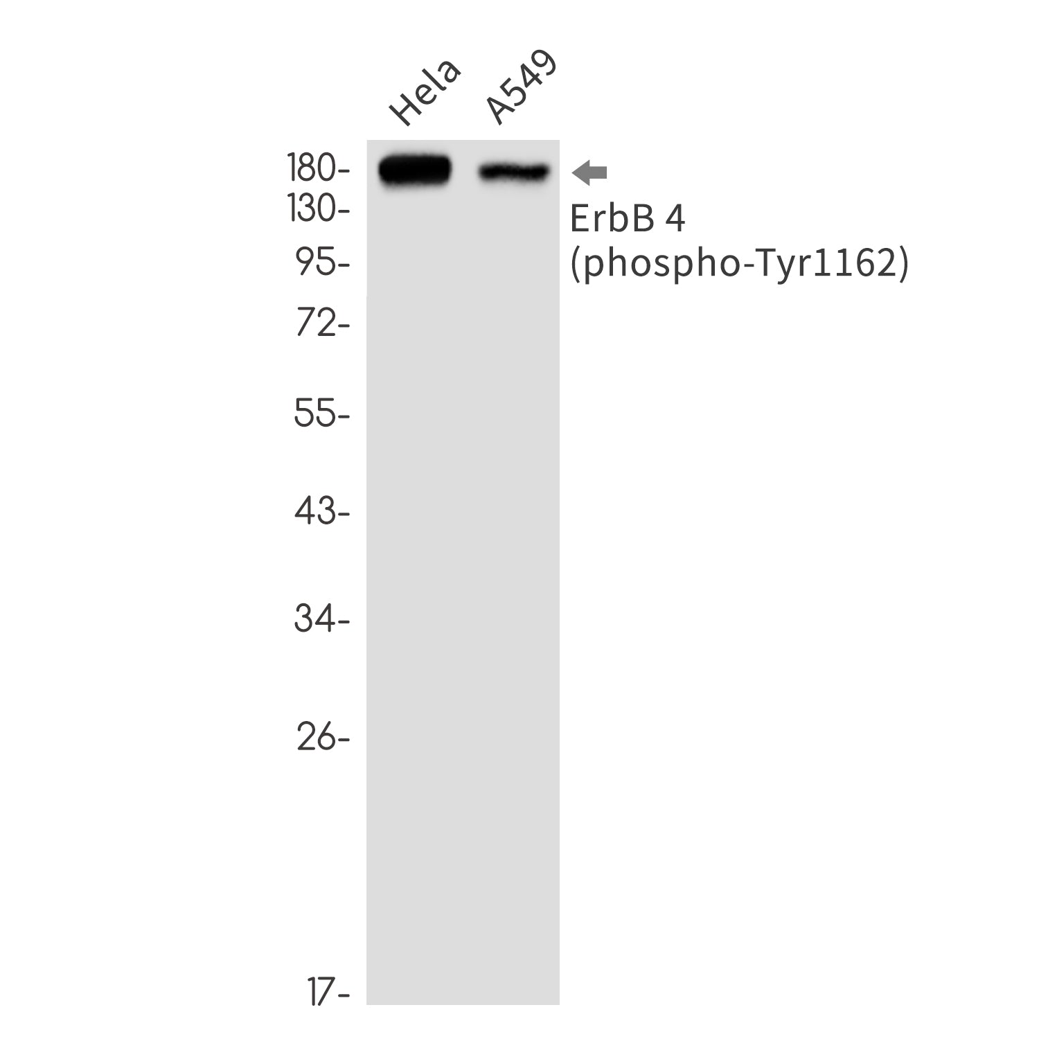 Anti-Phospho-ErbB 4 (Tyr1162) Rabbit Monoclonal Antibody