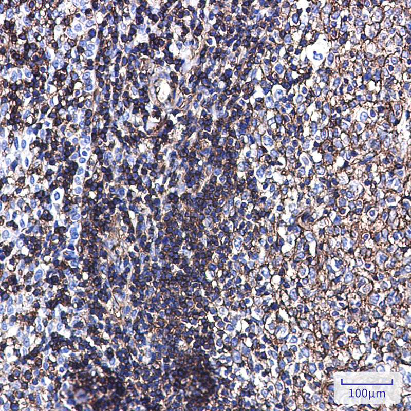 Anti-Phospho-Ezrin/Radixin/Moesin (Thr567/Thr564/Thr558) Rabbit Monoclonal Antibody