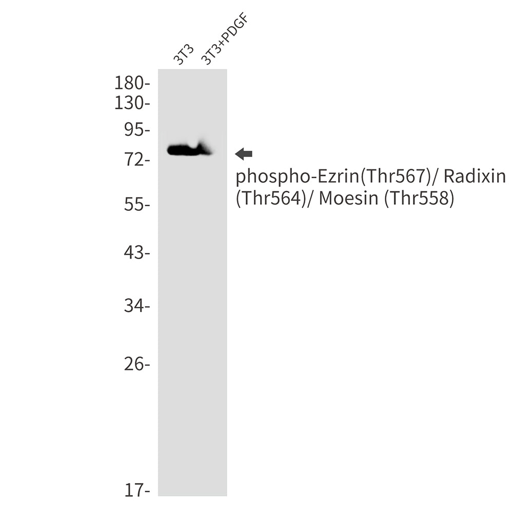 Anti-Phospho-Ezrin/Radixin/Moesin (Thr567/Thr564/Thr558) Rabbit Monoclonal Antibody