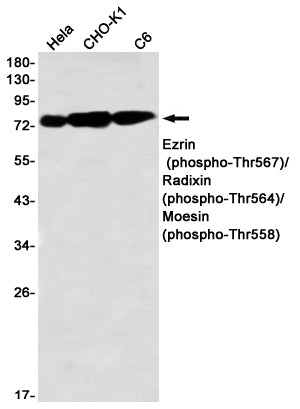 Anti-Phospho-Ezrin/Radixin/Moesin (Thr567/Thr564/Thr558) Rabbit Monoclonal Antibody
