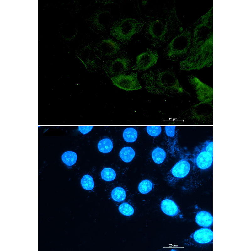Anti-Phospho-Filamin A/B (Ser2152/Ser2107) Rabbit Monoclonal Antibody