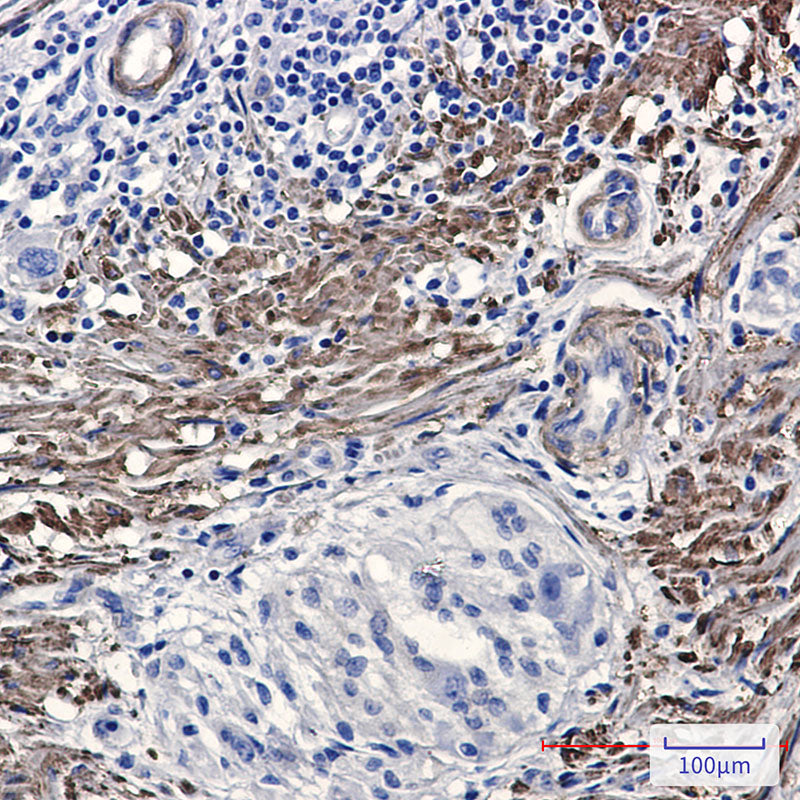 Anti-Phospho-Filamin A/B (Ser2152/Ser2107) Rabbit Monoclonal Antibody