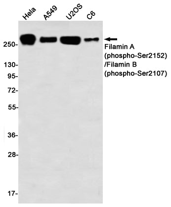 Anti-Phospho-Filamin A/B (Ser2152/Ser2107) Rabbit Monoclonal Antibody
