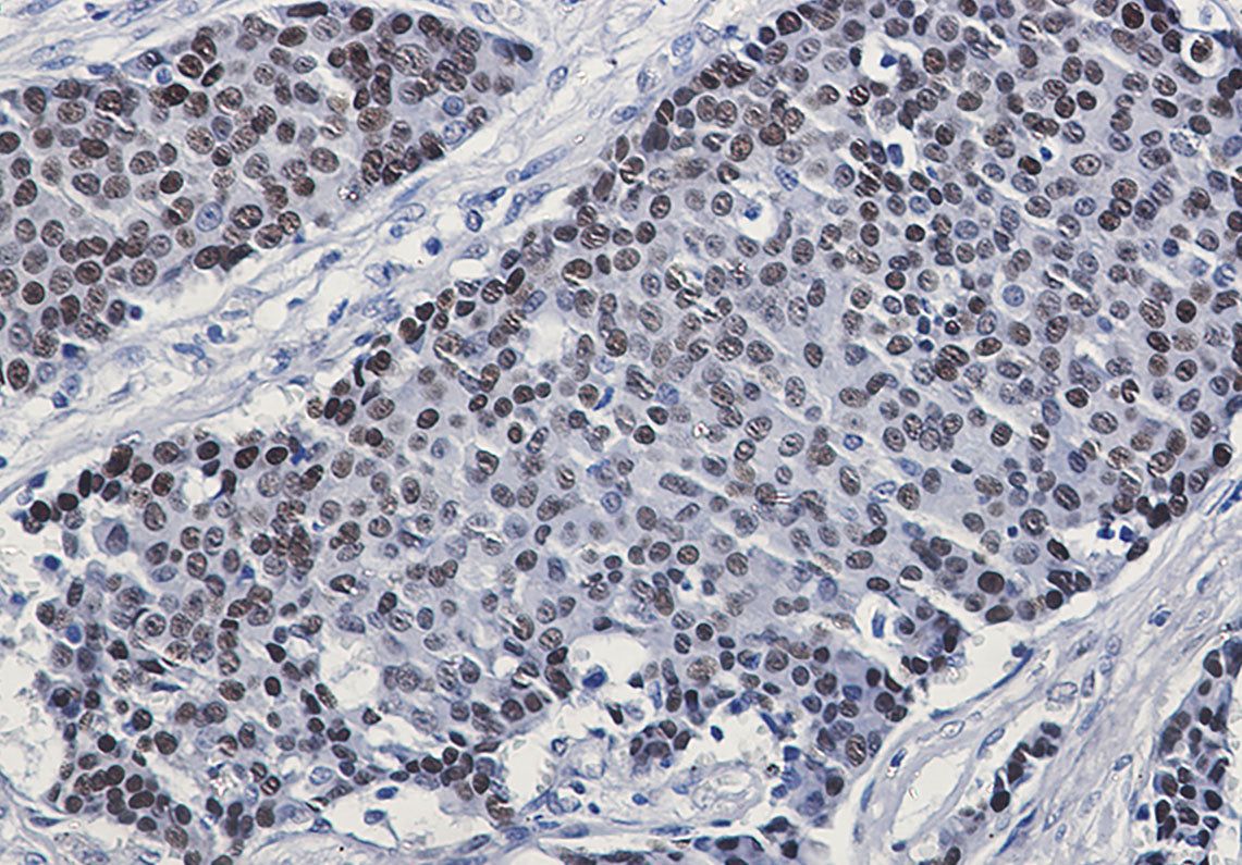 Anti-Phospho-GATA3 (Ser308) Rabbit Monoclonal Antibody