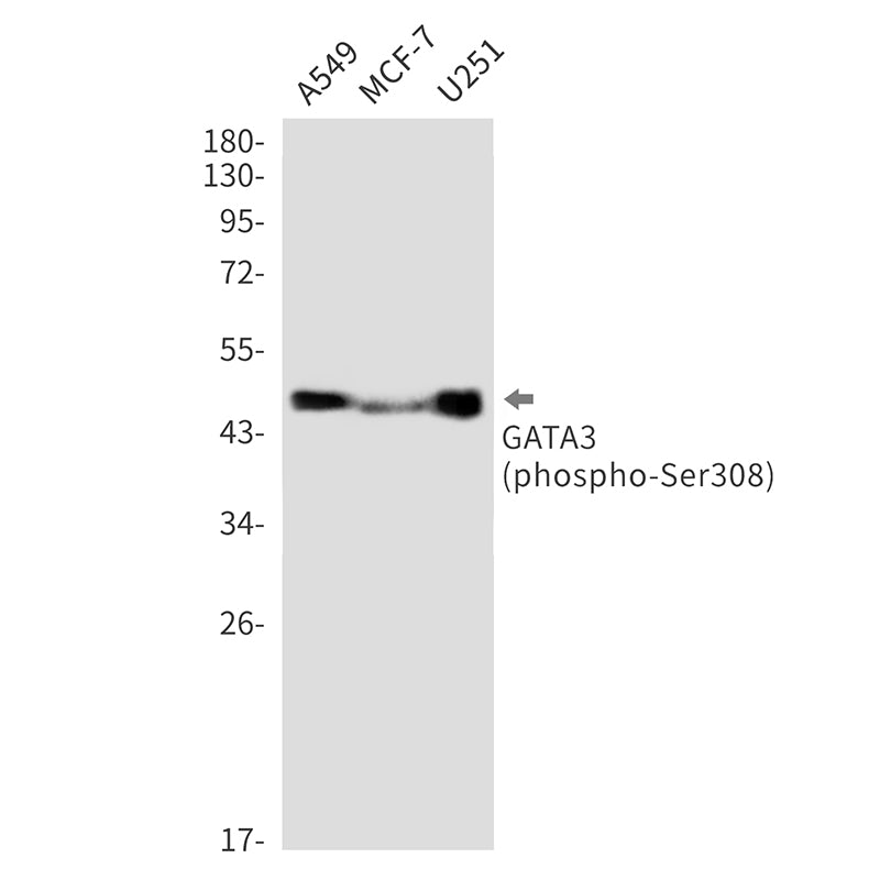Anti-Phospho-GATA3 (Ser308) Rabbit Monoclonal Antibody