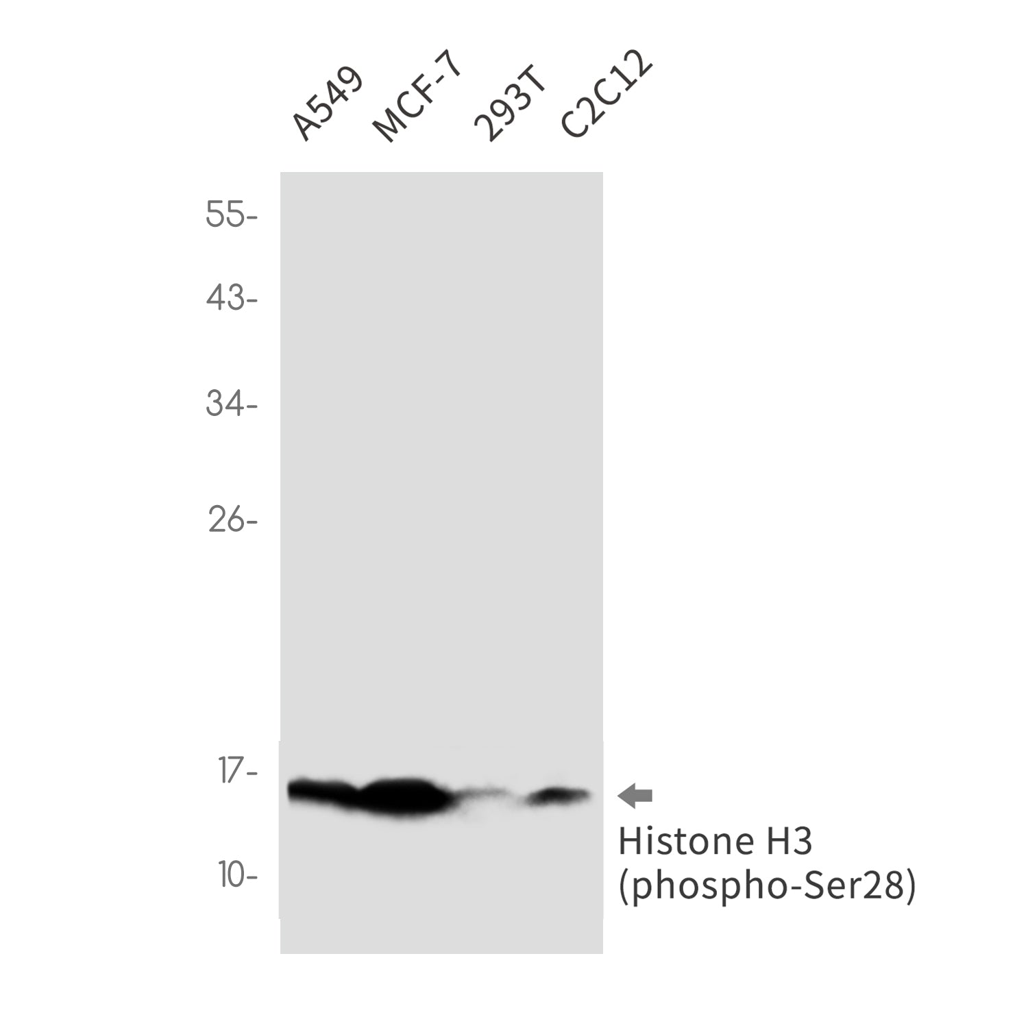Anti-Phospho-Histone H3 (Ser28) Rabbit Monoclonal Antibody