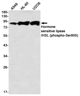 Anti-Phospho-Hormone Sensitive Lipase (Ser855) Rabbit Monoclonal Antibody