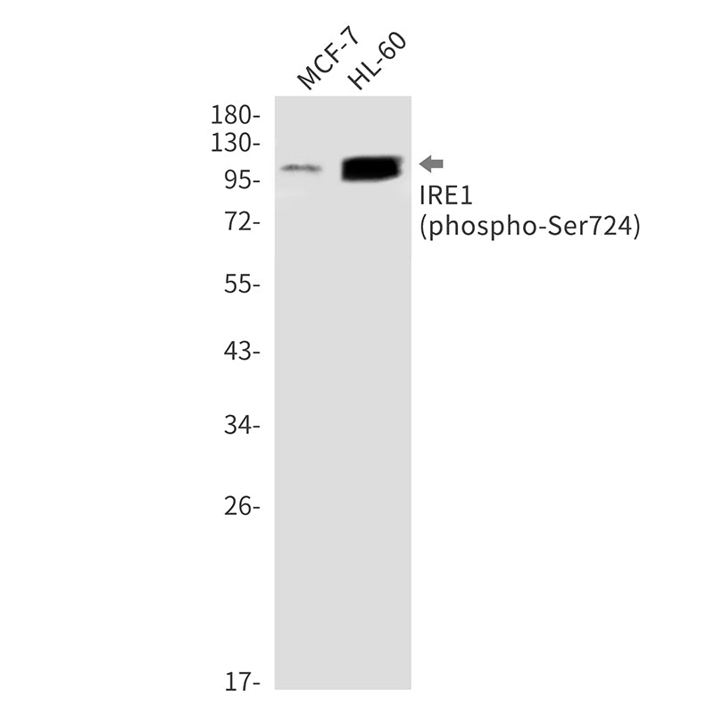 Anti-Phospho-IRE1 (Ser724) Rabbit Monoclonal Antibody