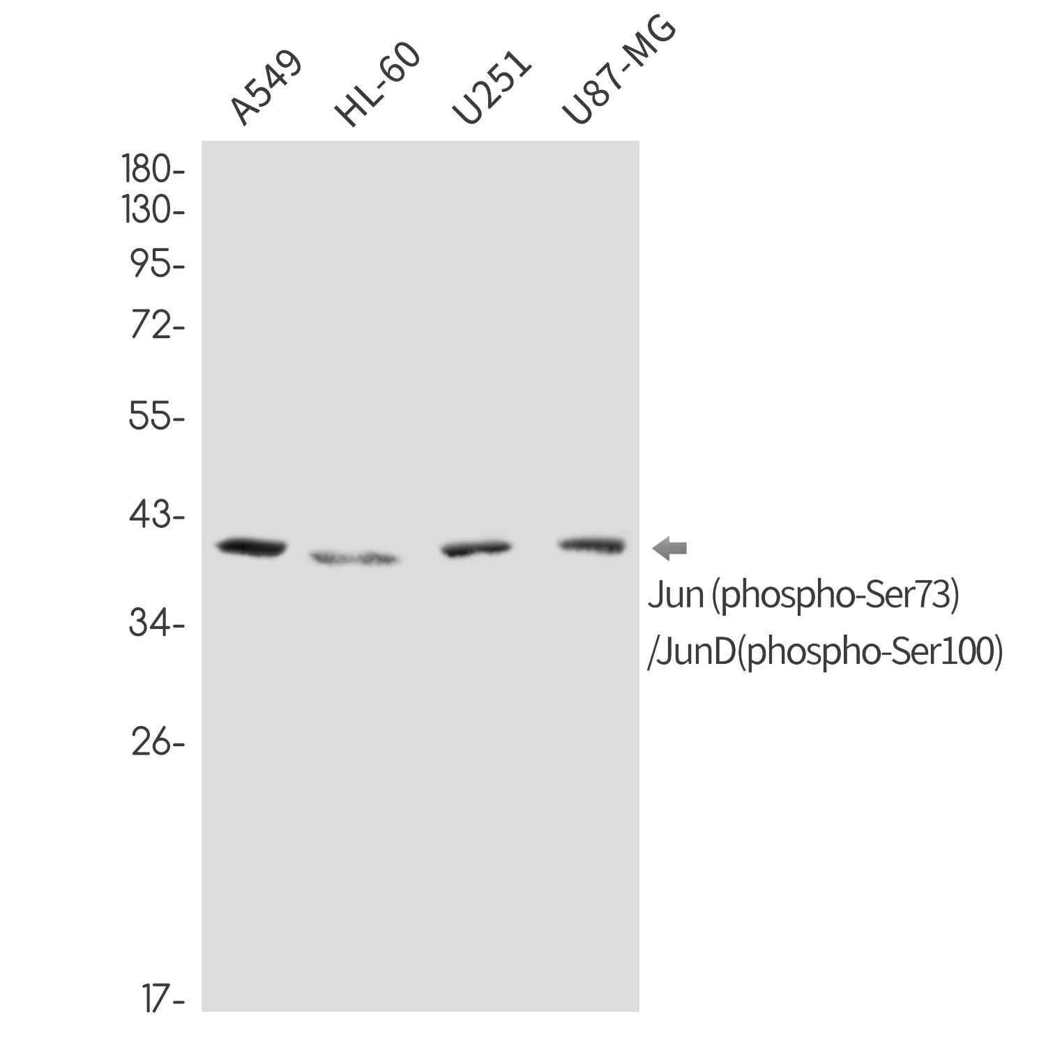 Anti-Phospho-Jun/JunD (Ser73/Ser100) Rabbit Monoclonal Antibody
