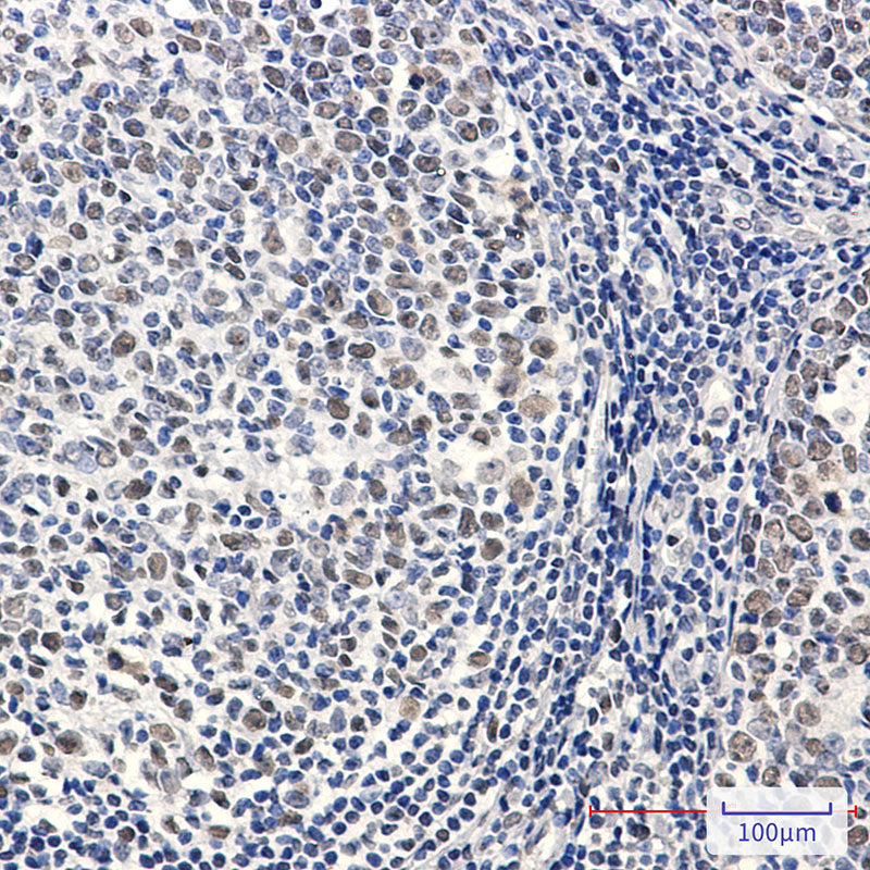 Anti-Phospho-MCM2 (Ser27) Rabbit Monoclonal Antibody