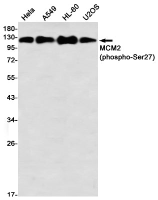 Anti-Phospho-MCM2 (Ser27) Rabbit Monoclonal Antibody