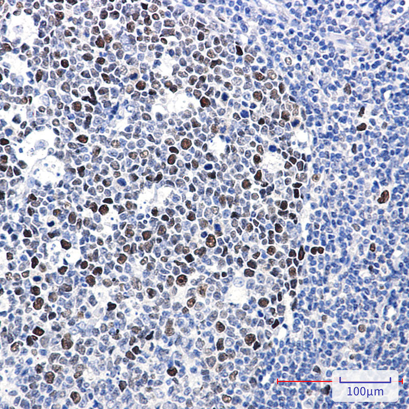 Anti-Phospho-MCM2 (Ser40) Rabbit Monoclonal Antibody