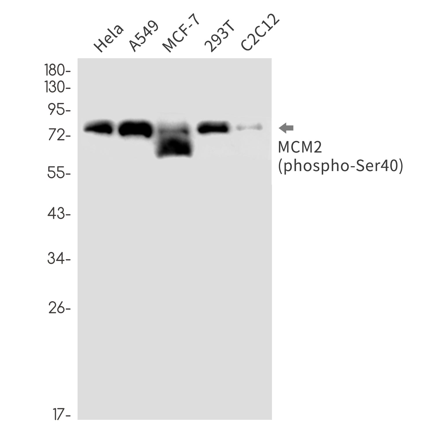 Anti-Phospho-MCM2 (Ser40) Rabbit Monoclonal Antibody