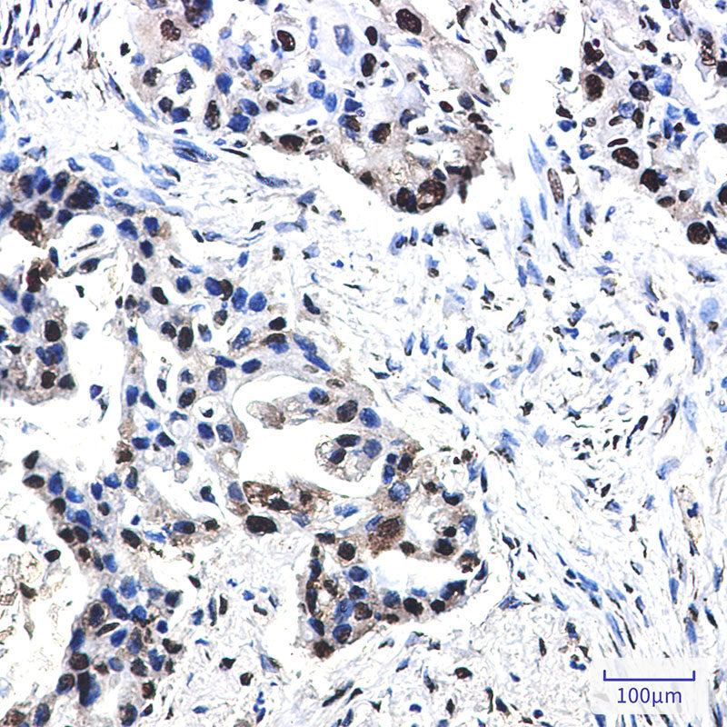 Anti-Phospho-Nucleophosmin (Thr199) Rabbit Monoclonal Antibody