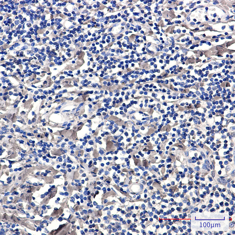 Anti-Phospho-PKC delta (Ser299) Rabbit Monoclonal Antibody