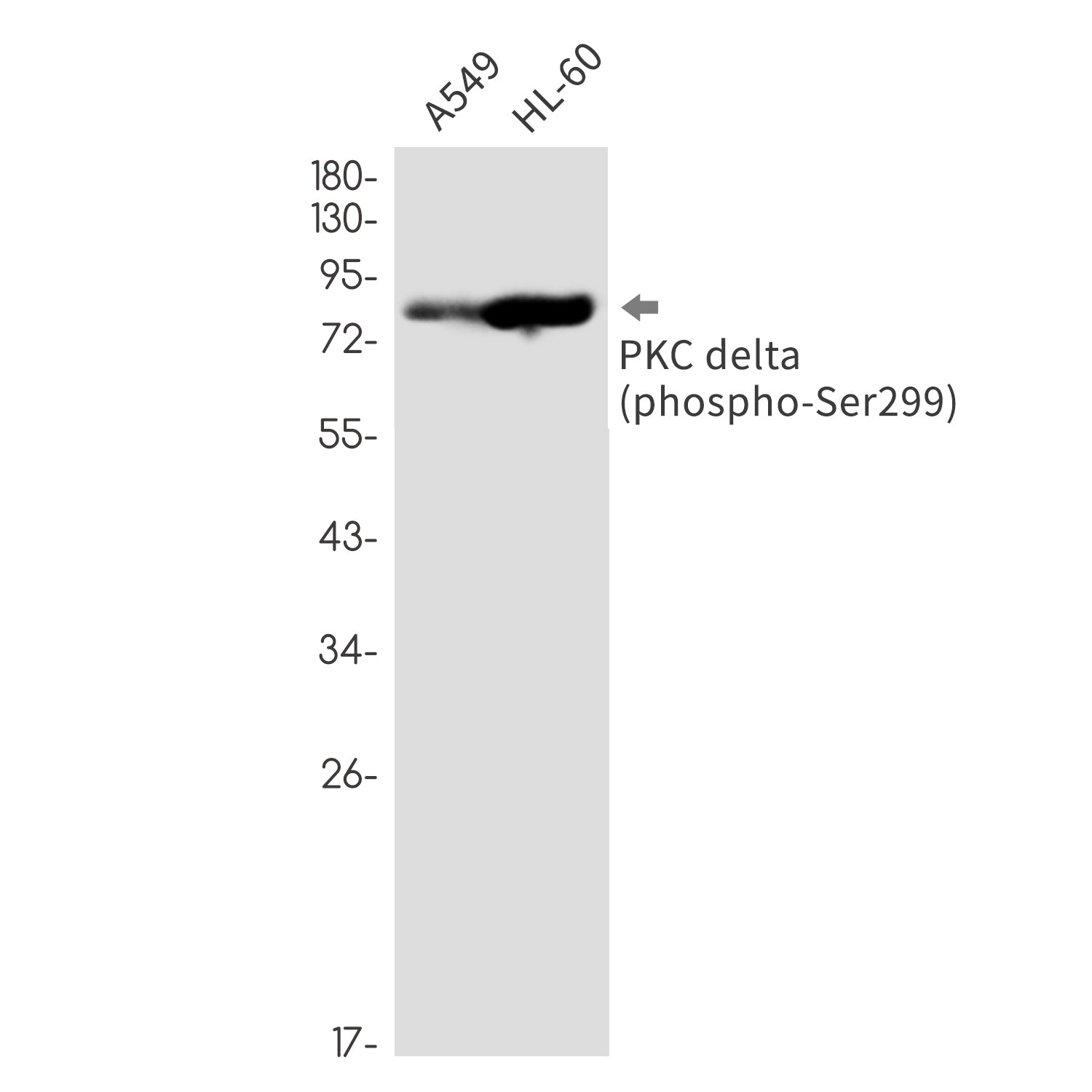 Anti-Phospho-PKC delta (Ser299) Rabbit Monoclonal Antibody