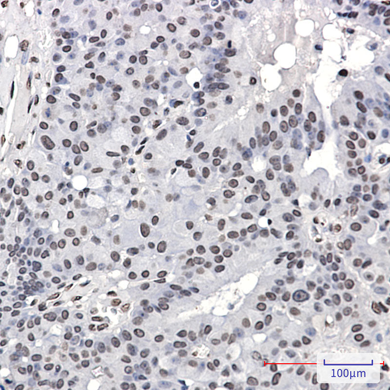 Anti-Phospho-PML Protein (Ser518) Rabbit Monoclonal Antibody