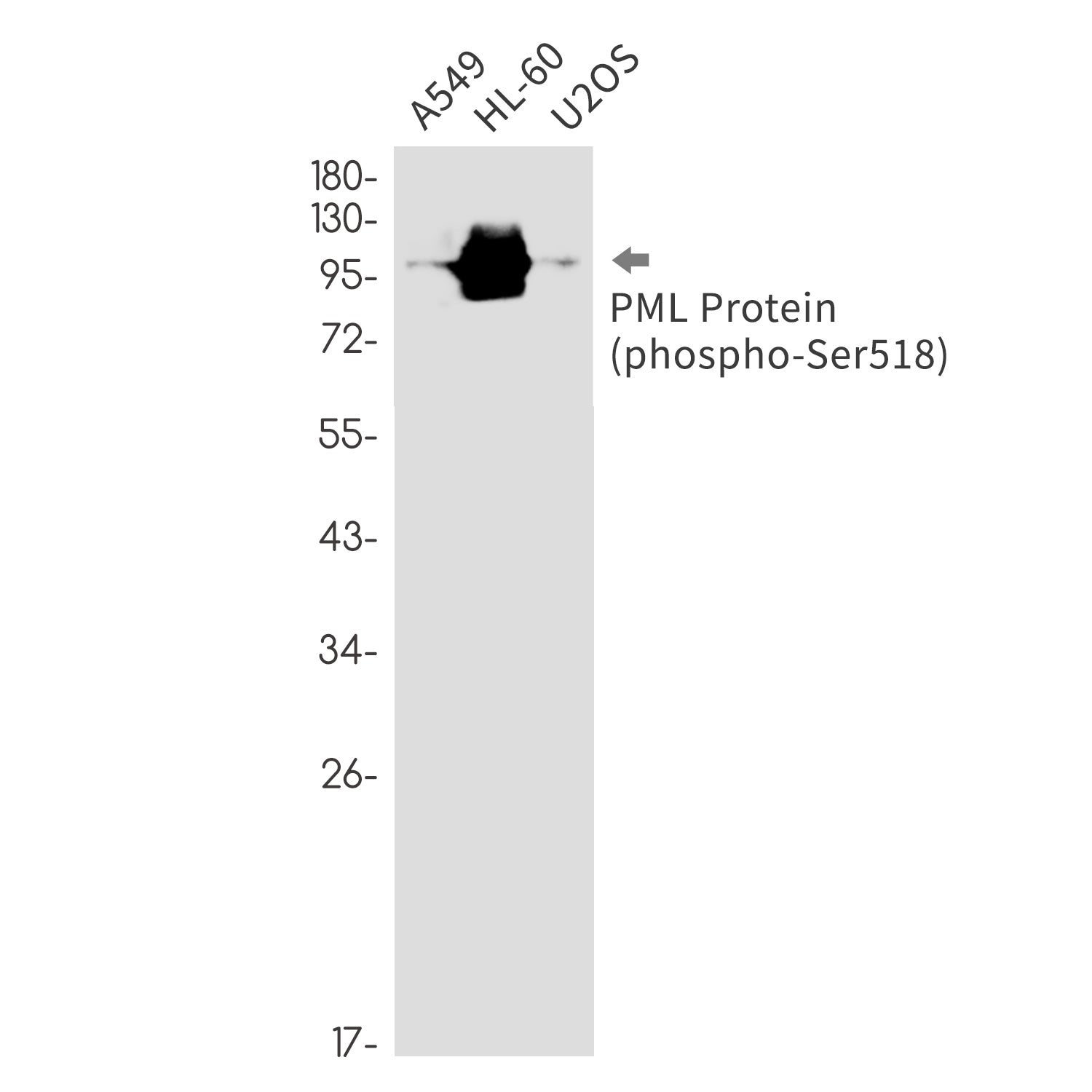 Anti-Phospho-PML Protein (Ser518) Rabbit Monoclonal Antibody