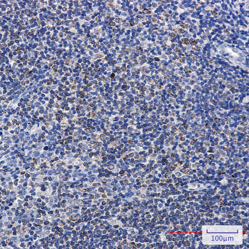 Anti-Phospho-PTP1B (Ser378) Rabbit Monoclonal Antibody