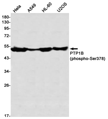 Anti-Phospho-PTP1B (Ser378) Rabbit Monoclonal Antibody