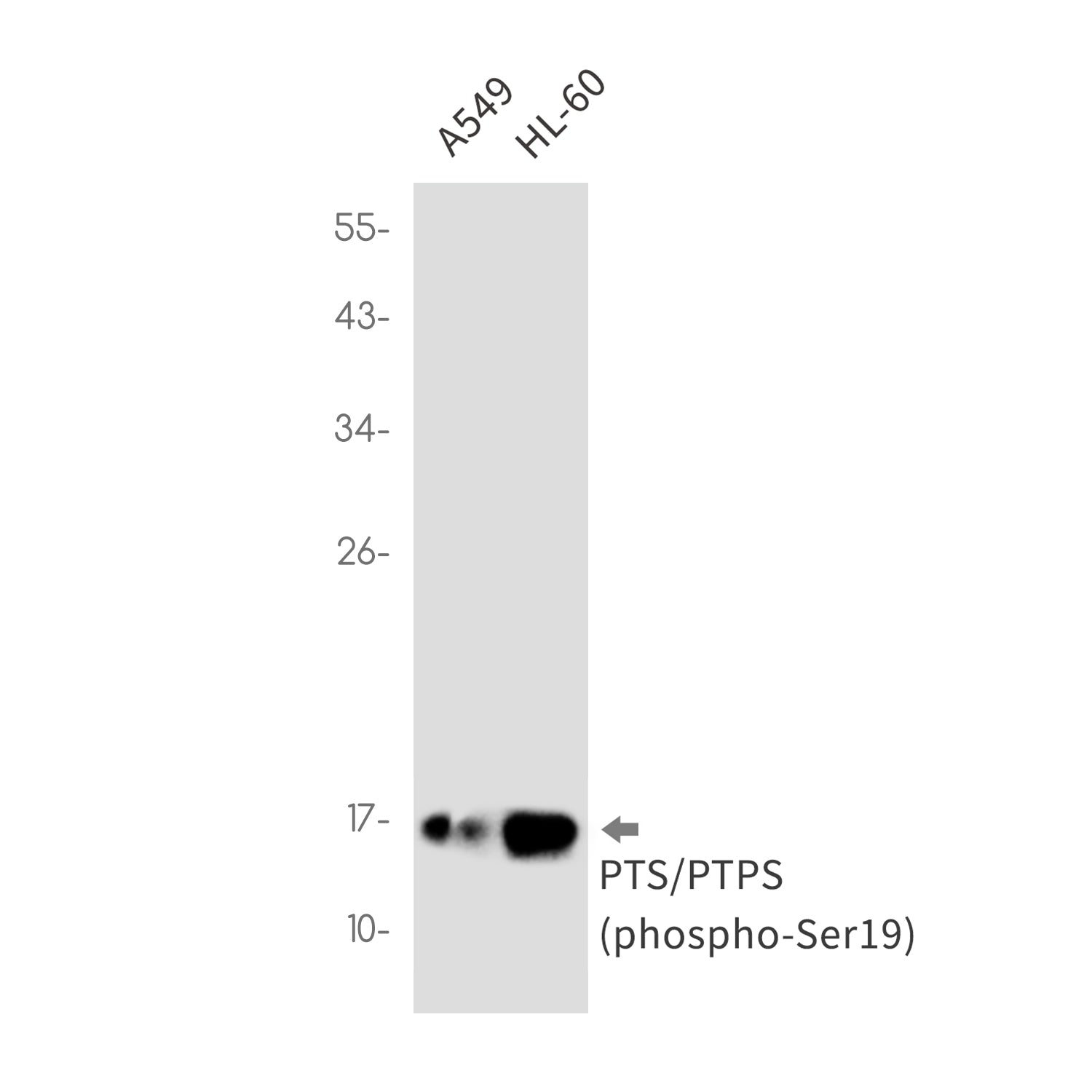 Anti-Phospho-PTS (Ser19) Rabbit Monoclonal Antibody