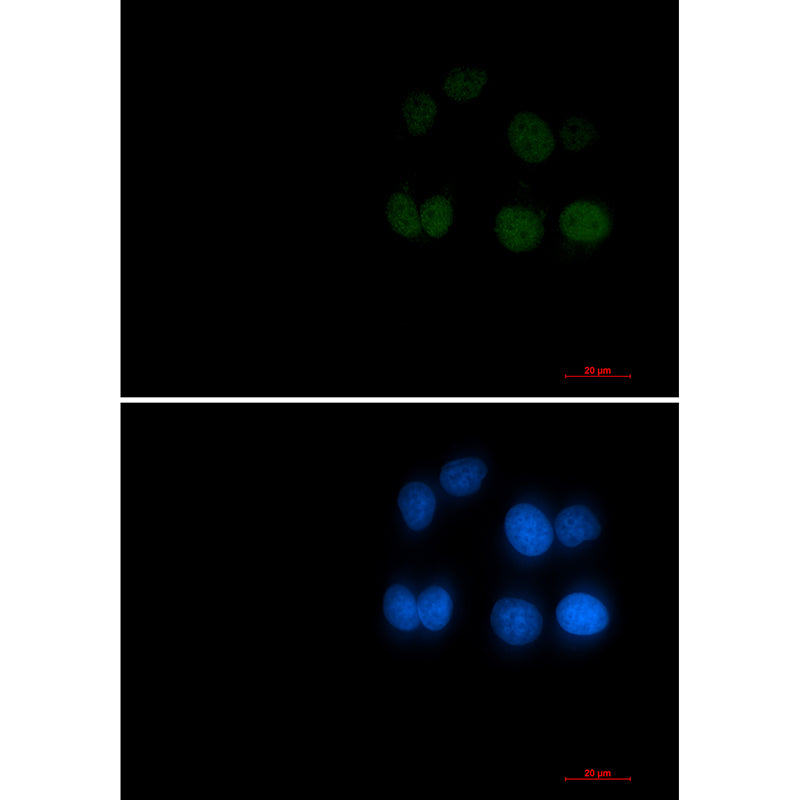 Anti-Phospho-Rad17 (Ser656) Rabbit Monoclonal Antibody
