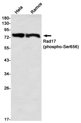Anti-Phospho-Rad17 (Ser656) Rabbit Monoclonal Antibody
