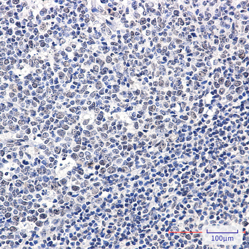 Anti-Phospho-Rb (Ser608) Rabbit Monoclonal Antibody