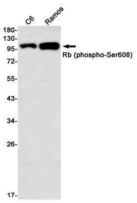 Anti-Phospho-Rb (Ser608) Rabbit Monoclonal Antibody