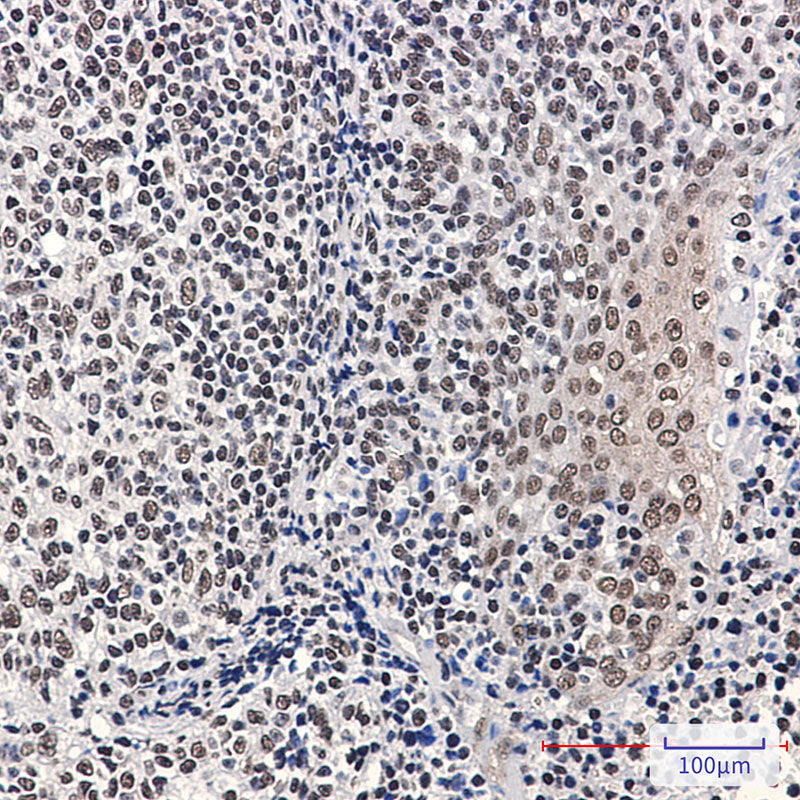 Anti-Phospho-Rb (Ser780) Rabbit Monoclonal Antibody