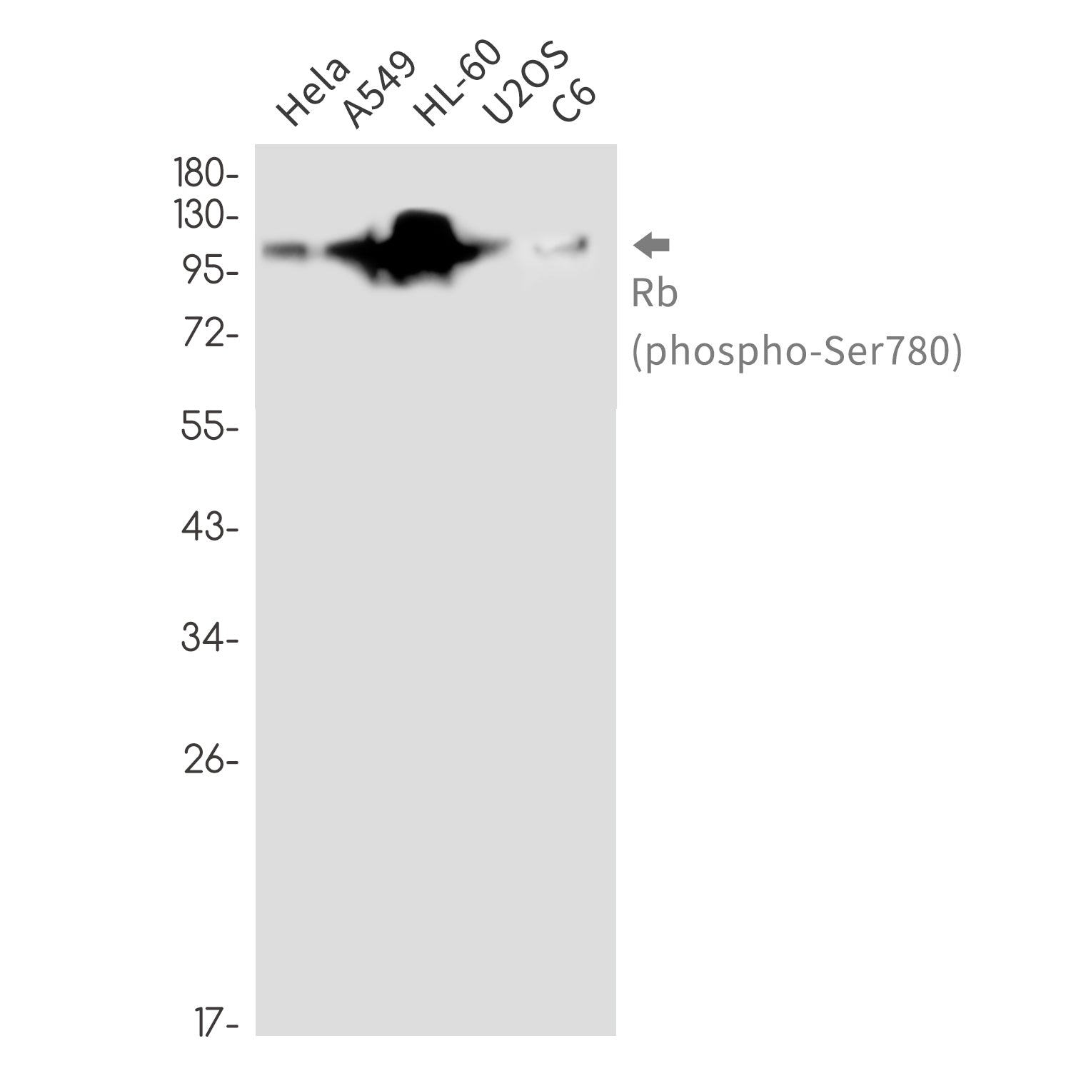 Anti-Phospho-Rb (Ser780) Rabbit Monoclonal Antibody