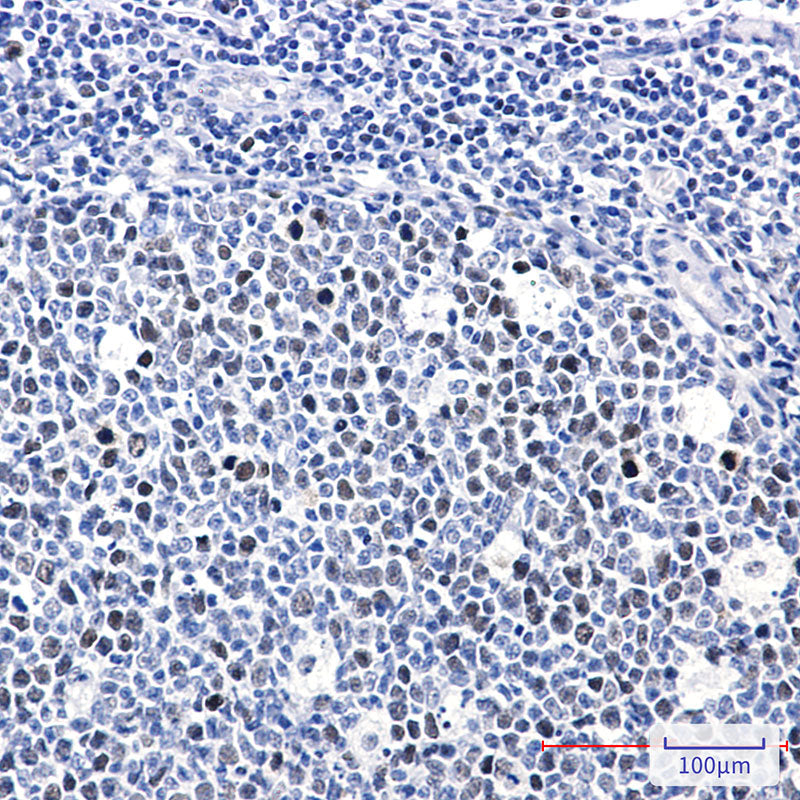 Anti-Phospho-Rb (Thr252) Rabbit Monoclonal Antibody