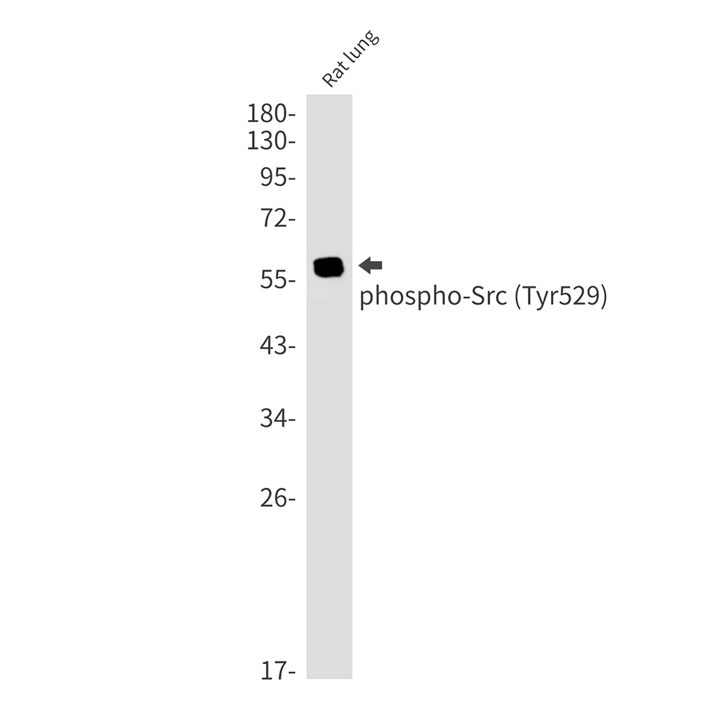Anti-Phospho-Src (Tyr530) Rabbit Monoclonal Antibody